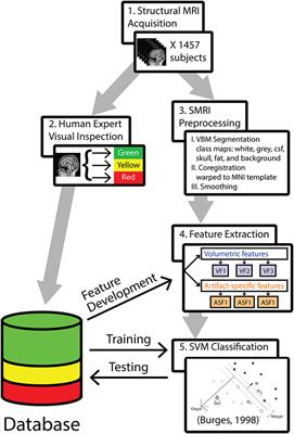 Automated Quality Assessment of Structural Magnetic Resonance Brain Images Based on a Supervised Machine Learning Algorithm